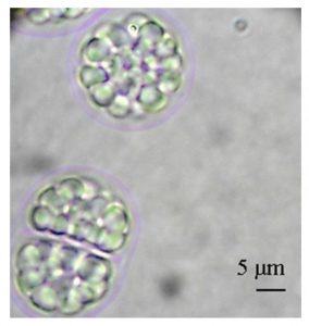 圖12. Aurantiochytrium limacinum（不知道中文叫什么，可以看到細(xì)胞里一個個油滴，by Abad &Turon, 2015）